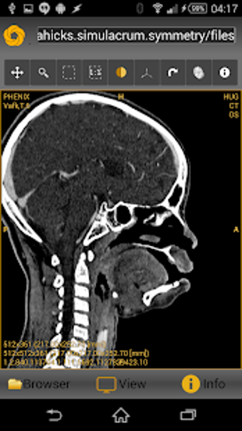 Image 0 for Symmetry DICOM