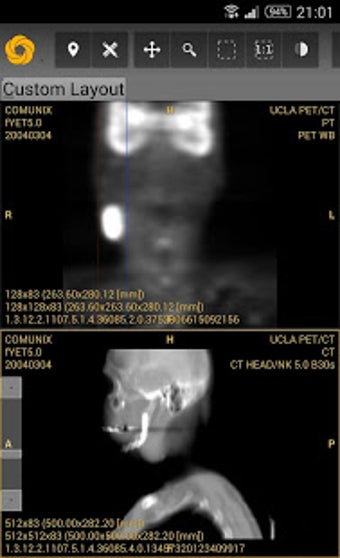 Image 3 for Symmetry DICOM
