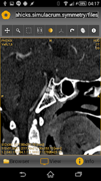 Image 1 for Symmetry DICOM