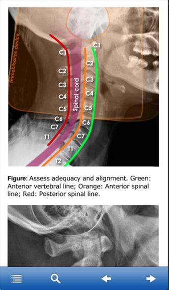 Imagen 3 para Advanced Trauma Life Supp…