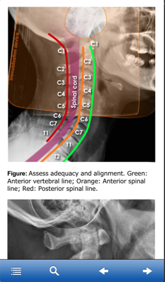 Image 0 for Advanced Trauma Life Supp…