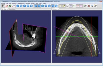 Imagen 0 para DentalViewer