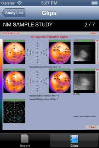 Image 0 for VidistarViewer