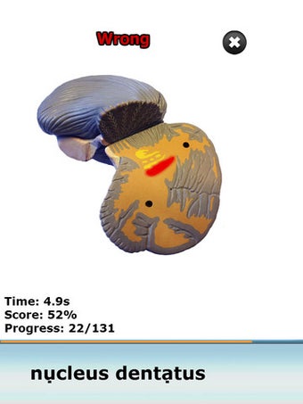 Image 5 for Anatomy Star - CNS (the B…