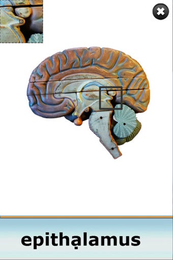 Image 3 for Anatomy Star - CNS (the B…