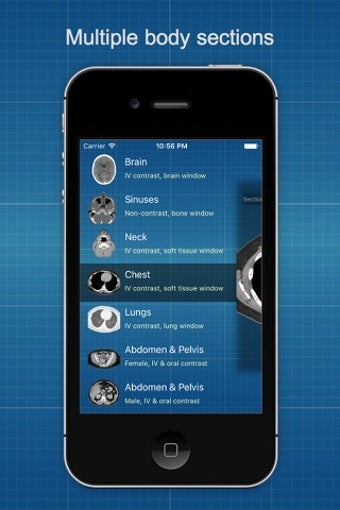 Image 0 for X-Anatomy Pro