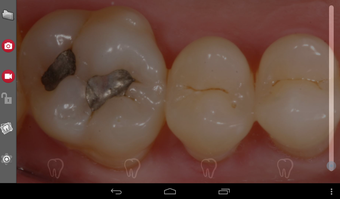 Image 2 for iOralCam Wireless intraor…
