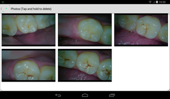 Image 1 for iOralCam Wireless intraor…