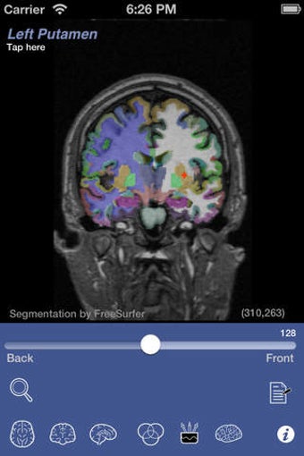 Imagen 0 para iSurf BrainView