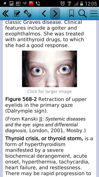 Image 0 for Nelson Textbook of Pediat…