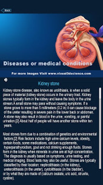 Imagen 2 para Urinary System Pro.