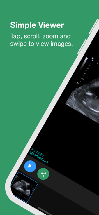 Image 2 for SCR iVue