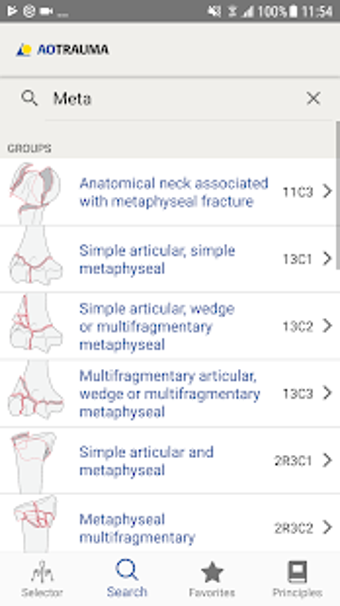 Image 2 for AO/OTA Fracture Classific…