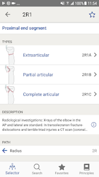 Image 1 for AO/OTA Fracture Classific…