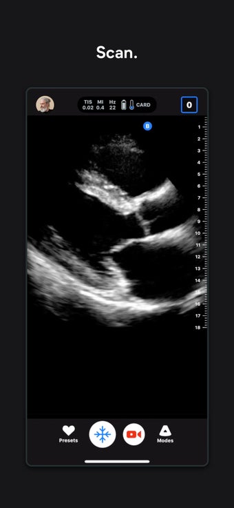 Image 3 for Butterfly iQ  Ultrasound