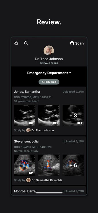 Image 1 for Butterfly iQ  Ultrasound
