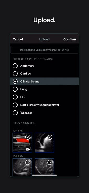 Image 0 for Butterfly iQ  Ultrasound