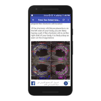 Imagen 3 para Obstetrics & Gyenacology …