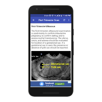 Imagen 2 para Obstetrics & Gyenacology …