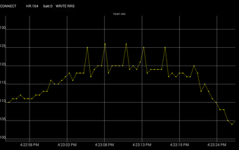 Imagen 0 para Arrhythmia monitor open s…