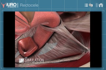 Imagen 0 para iURO Pelvic Floor PRO