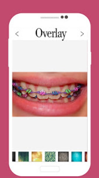 Image 0 for Braces Camera Editor