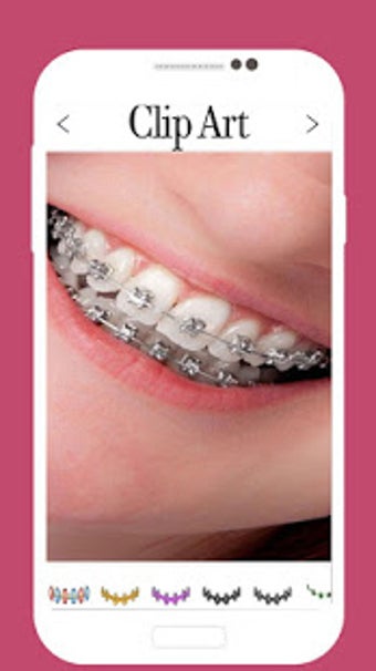 Image 1 for Braces Camera Editor