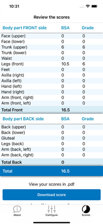 Image 0 for Vitiligo Calculator