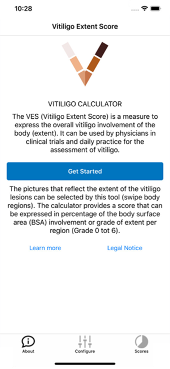 Image 1 for Vitiligo Calculator