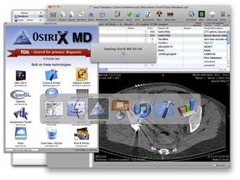Image 0 for OsiriX MD