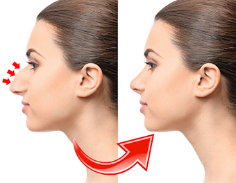 Image 2 for Nose Job Photo Editor