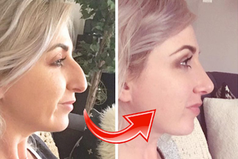 Image 0 for Nose Job Photo Editor