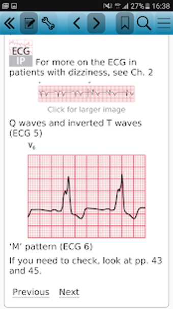 Imagen 2 para The ECG Made Easy, 8e