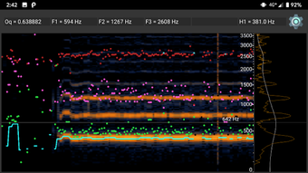 Image 1 for Speech analysis for Andro…