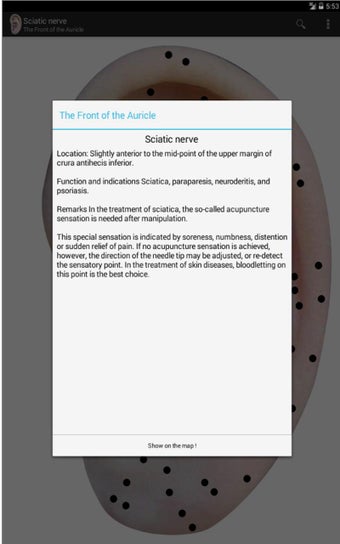 Image 1 for AcuMap EAR