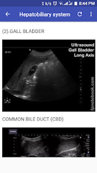 Imagen 2 para Abdomino-Pelvic Ultrasoun…