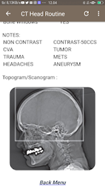 Image 1 for CT Scan Technique