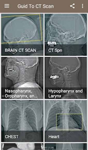 Image 3 for CT Scan Technique