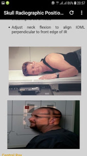 Image 0 for Positioning and Radiograp…