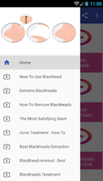 Imagen 2 para Remove Blackheads Videos