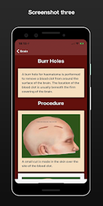 Image 1 for NeuroSurgery SP