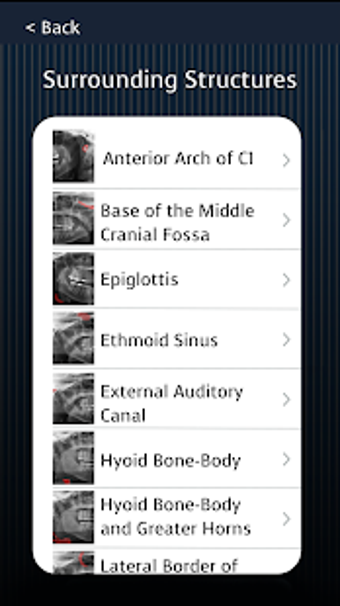 Image 1 for Dental Panoramic Radiolog…
