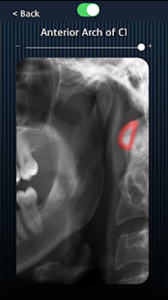 Image 3 for Dental Panoramic Radiolog…