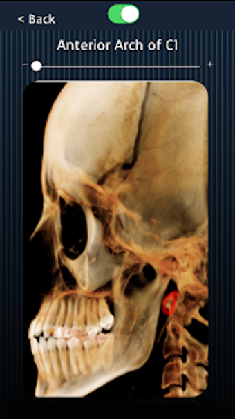 Image 0 for Dental Panoramic Radiolog…