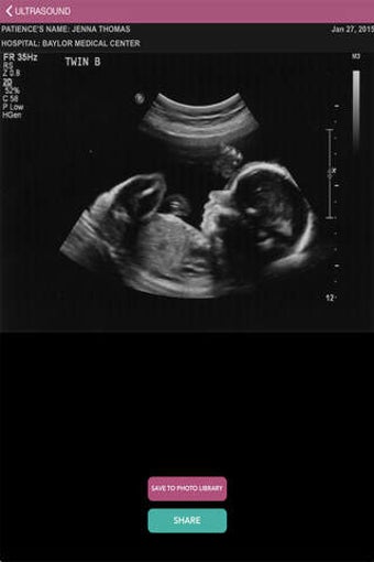 Image 0 for Baby Ultrasound 2015