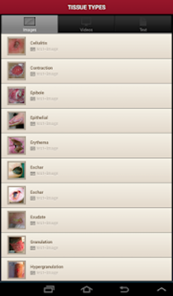 Imagen 1 para Wound Central
