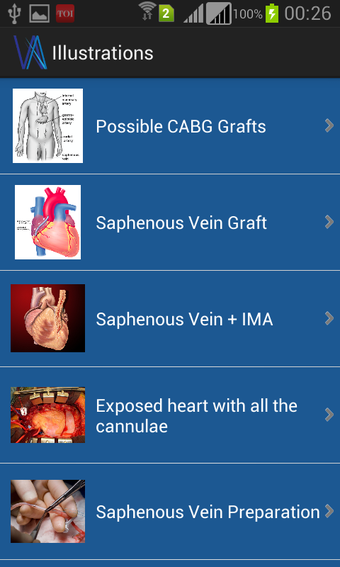 Image 1 for Vargo Anesthesia Mega App