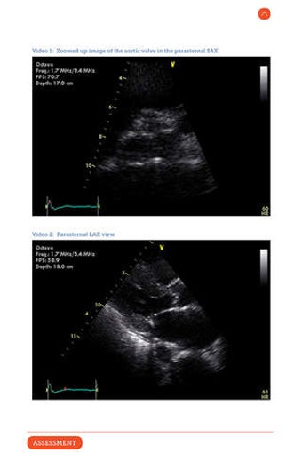 Imagen 0 para Ultrasound