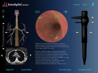 Image 0 for BronchPilot ANATOMY