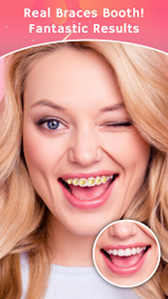Imagen 1 para Teeth Braces Photo Maker-…
